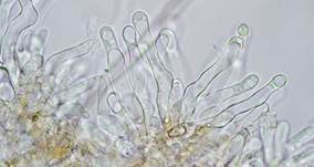 Rhomboidsporiger Flockenschüppling, Foto 13