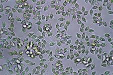 Rhomboidsporiger Flockenschüppling, Foto 11
