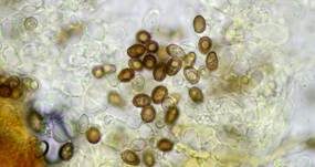 Riesenchampignon, Foto 66