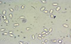 Rillstieliger Weichritterling, Foto 39
