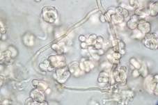 Rosa Kissenpilz, Foto 11