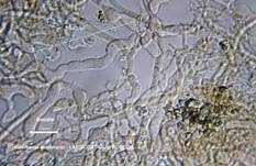 Rosafarbener Rindenpilz, Foto 26