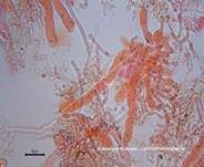 Rosafarbener Rindenpilz, Foto 36
