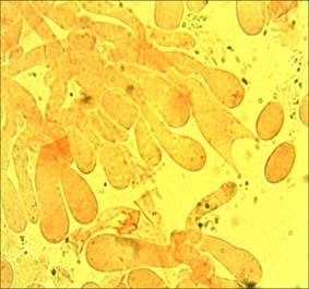 Rosaschimmerndes Fadenkeulchen, Foto 5