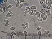 Rotstieliger Rübling, Foto 32