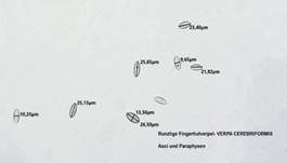 Runzelige Fingerhutverpel, Foto 33