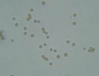 Abgeflachtes Stummelfüßchen, Foto 24