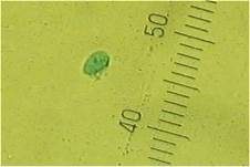 Sandtellerling, Foto 12