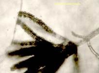 Schimmelpilz, Foto 191