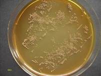 Schimmelpilz, Foto 506