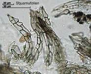 Schwarzer Kotpilz, Foto 19