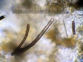 Schwarzer Stängelschimmel, Foto 6