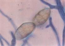 Schwärze-Schimmelpilz Alternaria, Foto 12