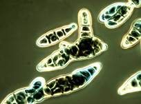Schwärze-Schimmelpilz Alternaria, Foto 13