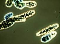 Schwärze-Schimmelpilz Alternaria, Foto 15