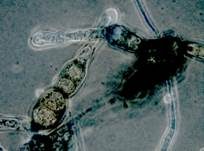 Schwärze-Schimmelpilz Alternaria, Foto 16