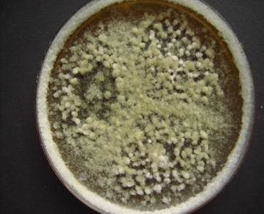 Schwärze-Schimmelpilz Alternaria, Foto 4