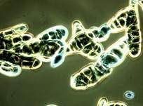 Schwärze-Schimmelpilz Alternaria, Foto 7
