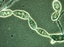 Schwärze-Schimmelpilz Alternaria, Foto 8