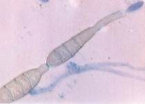 Schwärze-Schimmelpilz Alternaria, Foto 9