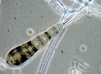 Schwärze-Schimmelpilz Alternaria, Foto 10