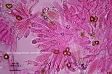 Schwarzfüssiger Risspilz, Foto 25