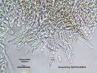 Schwarzhütiger Steinpilz, Foto 33