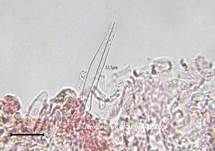 Schwarzhütiger Steinpilz, Foto 38