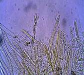 Schwefelgelbes Kernpilz-Becherchen, Foto 11