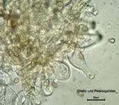 Seidiger Risspilz, Foto 26