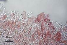 Shiitake, Foto 26