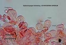 Spitzschuppiger Schirmling, Foto 76