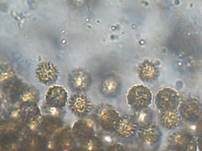 Sternsporiger Laubtrüffel, Foto 8