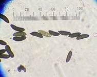 Subiculum-Schwarzbrust, Foto 12