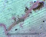 Subiculum-Schwarzbrust, Foto 13