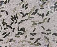 Subiculum-Schwarzbrust, Foto 14