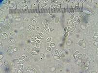 Tabakbraune Borstenscheibe, Foto 11