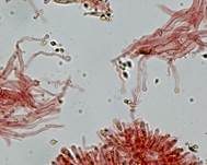 Tautropfen-Scheinhelmling, Foto 10
