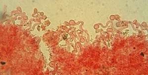 Tautropfen-Scheinhelmling, Foto 11