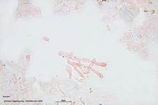 Tiegelteuerling, Foto 72