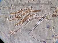Weidenkätzchen-Becherling, Foto 12