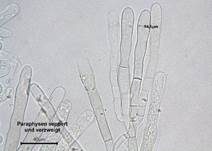 Braune Speisemorchel, Foto 18