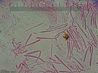 Weißes Haarbecherchen, Foto 36