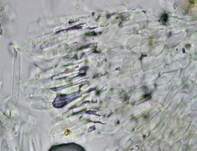 Weißes Stielhaarbecherchen, Foto 6