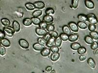 Weißflockiger Schirmling, Foto 18