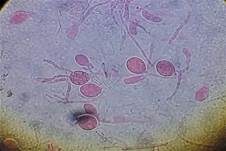 Weißlicher Drüsling, Foto 25