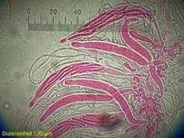 Weißwolliger Kugelpilz, Foto 21