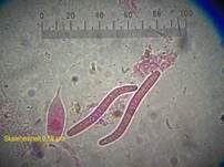 Weißwolliger Kugelpilz, Foto 23