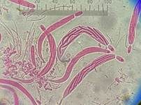 Weißwolliger Kugelpilz, Foto 28