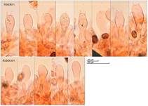 Wiesenchampignon, Foto 34